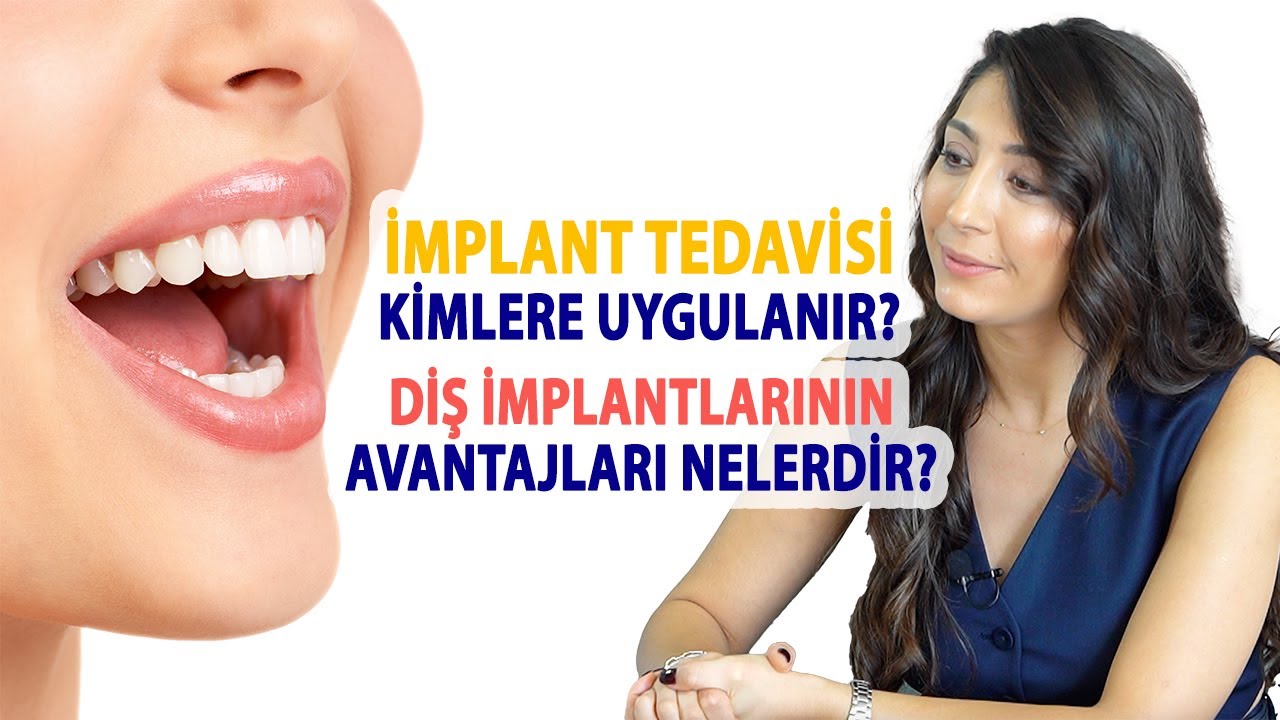 İmplant Tedavisi Kimlere Uygulanır, Diş İmplantlarının Avantajları Nelerdir?