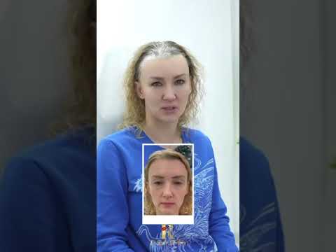 Get a Youthful Look: Botox, Fillers & More At C37 Medical Hub - Image 6