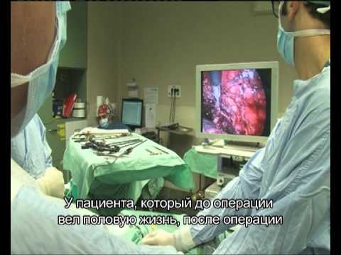 Лечения простатита в барнауле - Болиголов лечение простатита
