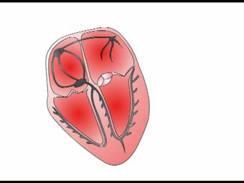 ECG Interpretation - The Cardiac Axis (Section 2, Part 3)