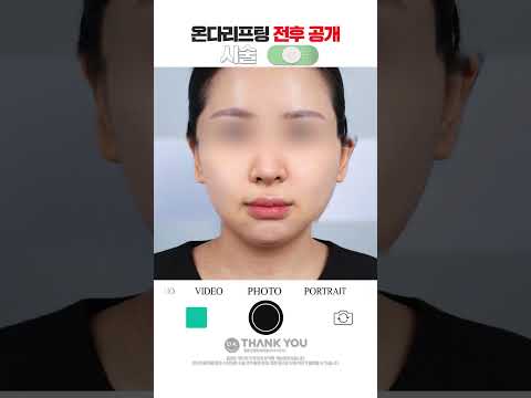 땡큐성형외과 Clips