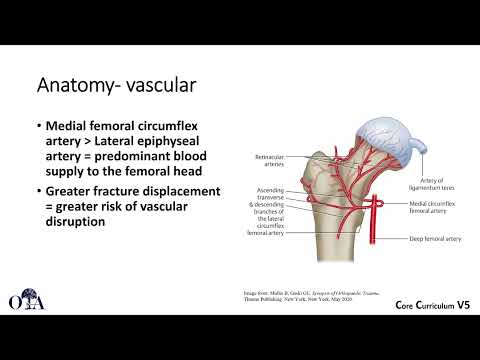 Femoral neck fractures in patients younger than 50 years - 1 of 3
