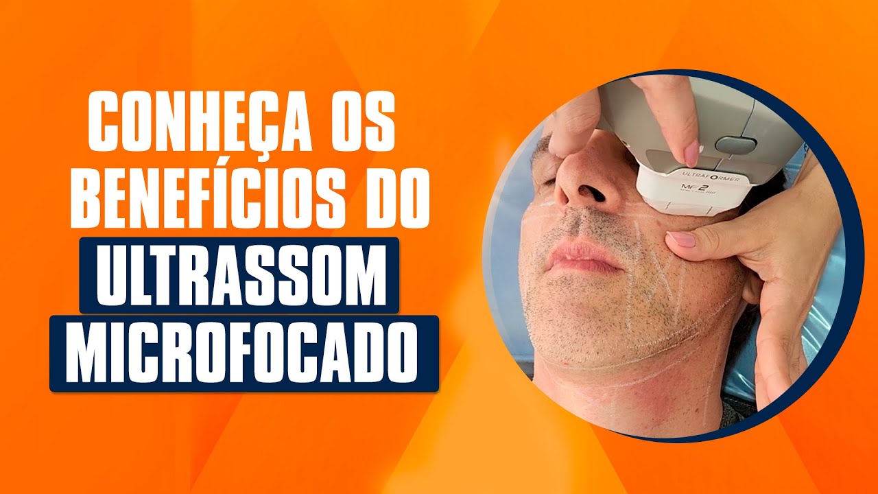 Conheça os benefícios do Ultrassom Microfocado