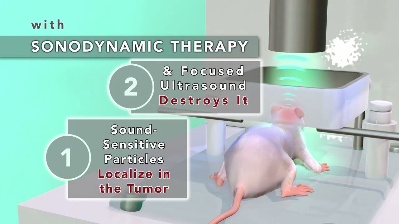 Sonodynamic Intracranial Tumor Therapy