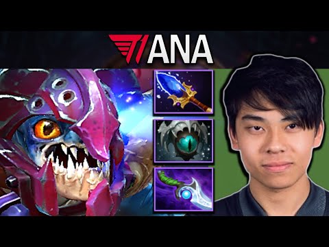 Slark Dota 2 Gameplay T1.Ana with 20 Kills and Diffusal - Aghanims #dota2 #dota2gameplay