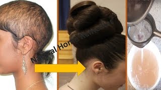 ⭐AWARDED BEST HAIR GROWTH REMEDY TO GROW HAIR IN 4 WEEKS || FIX HAIR FALL || Natural Home Remedies