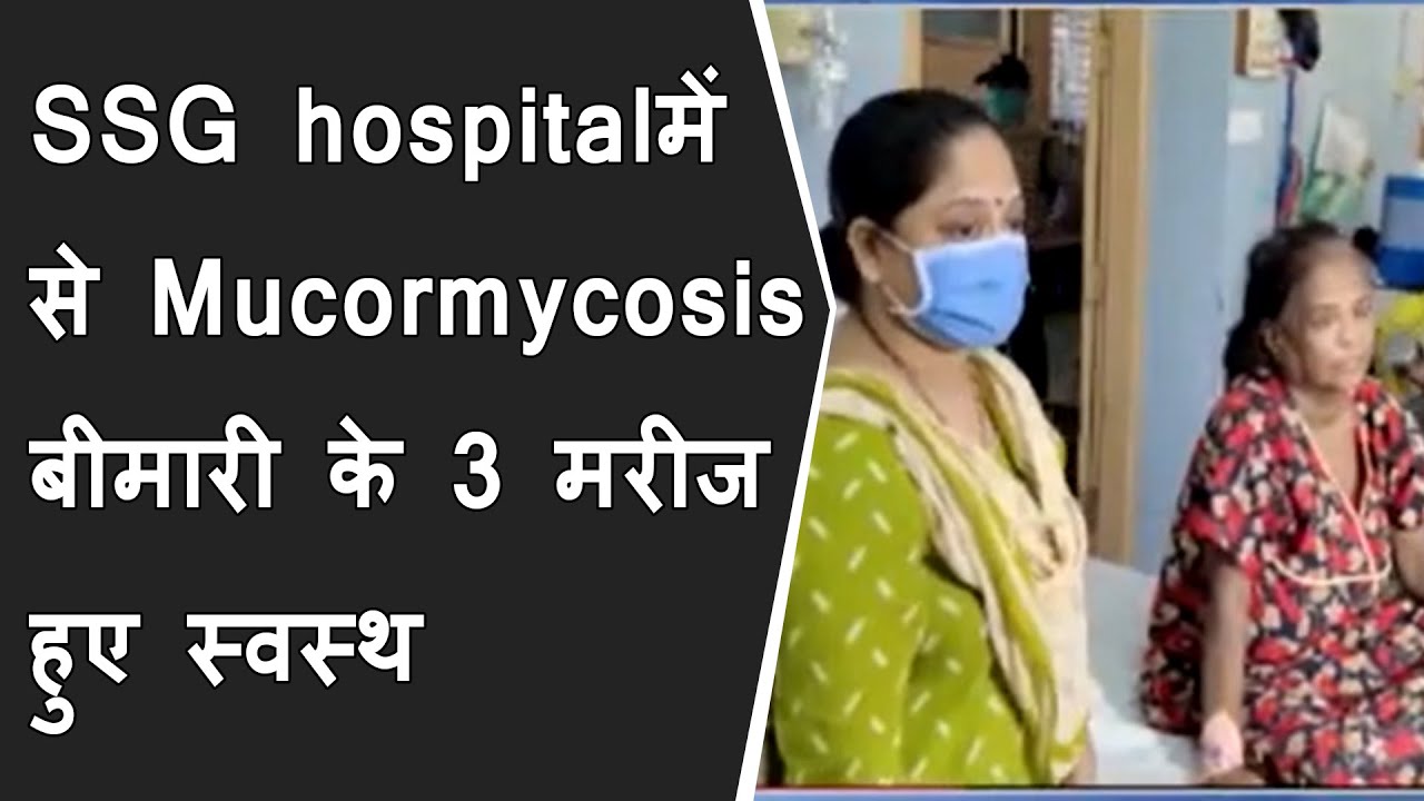 SSG hospitalमें से Mucormycosis बीमारी के 3 patient को स्वस्थ करके घर रवाना किया | Mucormycosis news