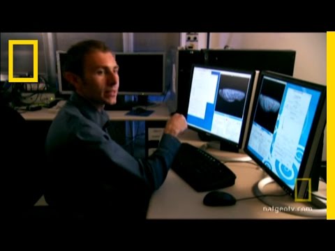 Whose Leg is This? | National Geographic