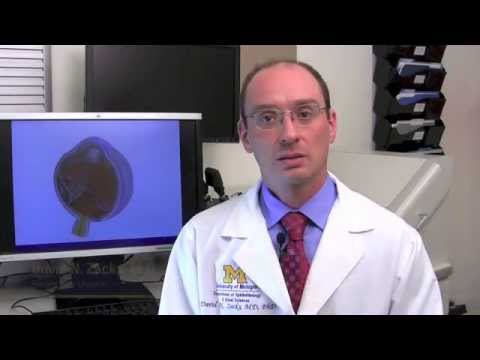 Was sind die Symptome einer Netzhautablösung?