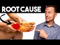 Peripheral NEUROPATHY Root Cause And Best Remedy Dr Berg