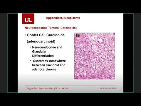 10.15.2021, “Appendiceal Neoplasms”