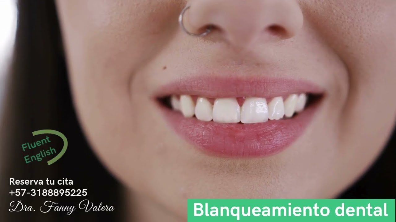 Fanny Valera Velásquez-128