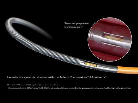 Abbott FFR Epicardial