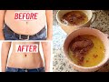 1 Drink That Will Remove Your Stubborn Stomach Fat | MELT BELLY FAT IN 3 DAYS!! No Exercise No Diet