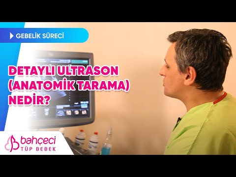 Detaylı Ultrason veya Anatomik Tarama Nedir?