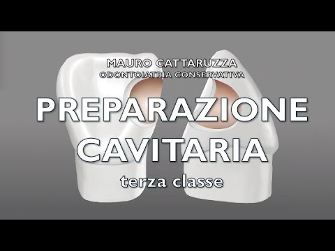 ODONTOIATRIA CONSERVATIVA. Preparazione cavitaria di terza classe.