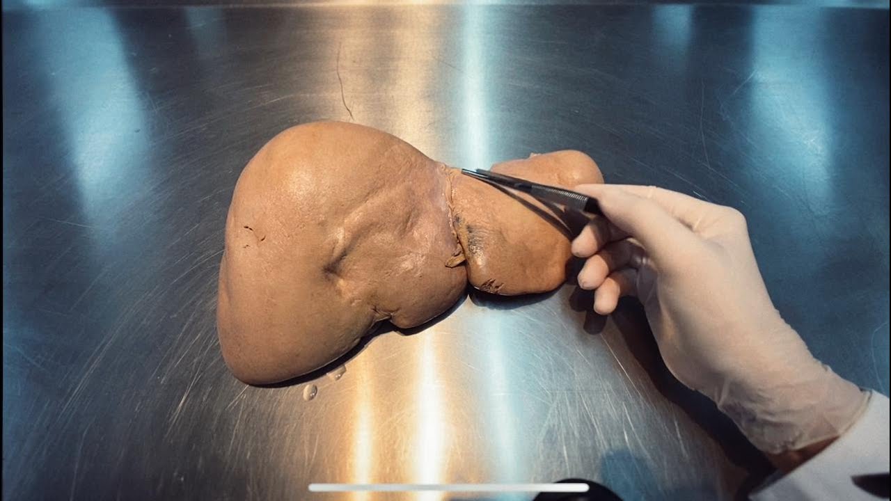 Anatomia do Fígado e ligamentos hepáticos + vesícula biliar e ductos biliares - aula prática