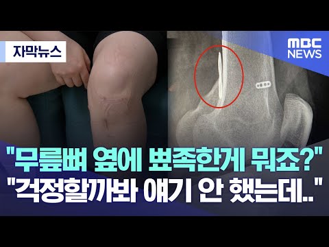 [자막뉴스] "무릎뼈 옆에 뾰족한게 뭐죠?" "걱정할까봐 얘기 안 했는데.."(2022.09.17/MBC뉴스)