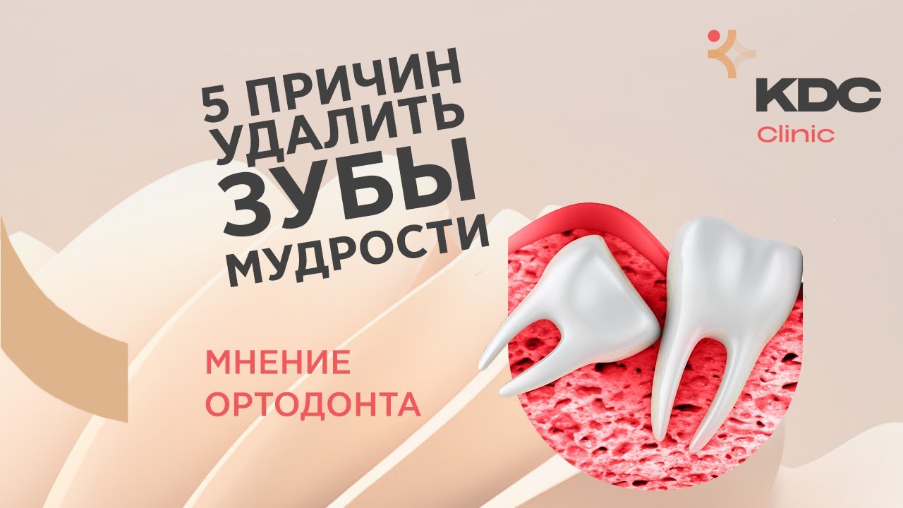 5 причин удалить зубы мудрости