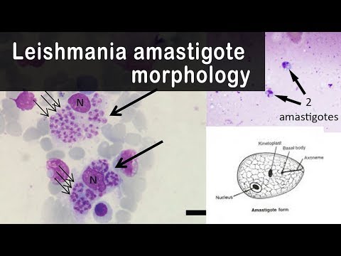 Leishmania paraziták képeket - Leishmaniasis tünetei és kezelése - HáziPatika