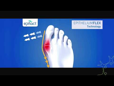 Epitact Bunion Corrector Reviews