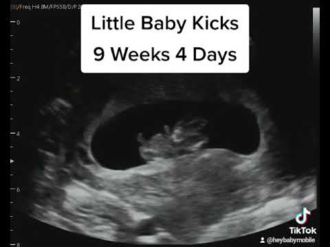 Baby Kicks on Ultrasound at 9 Weeks 4 Days Pregnant