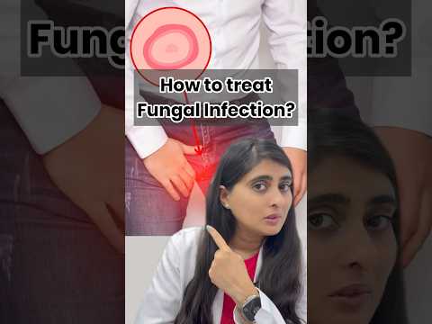 Fungal infection on skin | Ointment for fungal infection | Fungal infection in private parts
