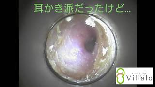 耳掃除動画vol.13「耳かき派だったけど…」