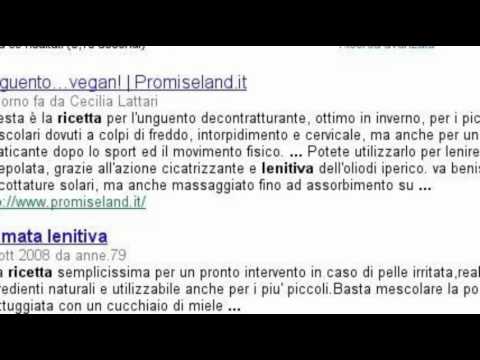Siccome il pigmentary nota su unocchiata di faccia Il pigmentary nota su un bulbo oculare
