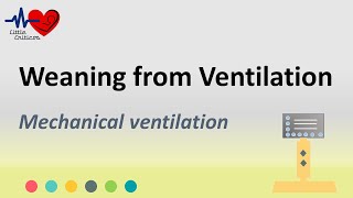 Weaning from ventilator | Mechanical ventilation | Little Criticos
