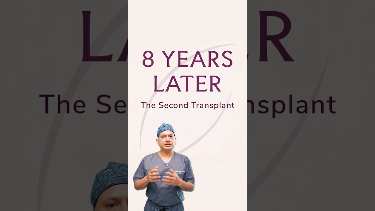 The Hair Transplant No One Talks About: The Second One
