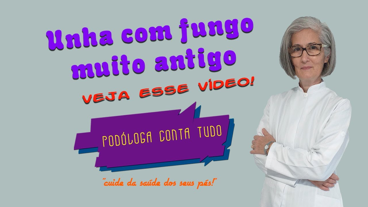 UNHA COM FUNGO MUITO ANTIGO: VEJA COMO CUIDAR EM CASA!