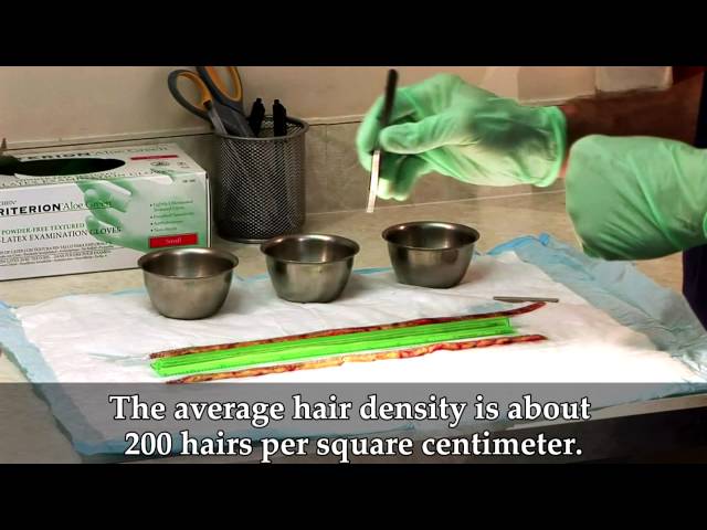 Aldo's Surgery