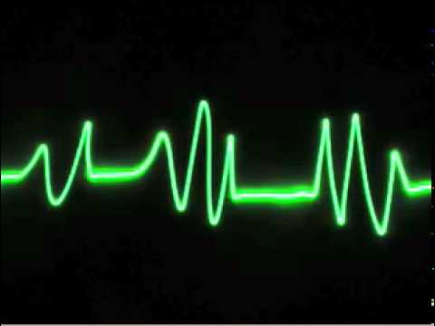 Vital Signs - Andrew Bucknill and Mike Goodfellow [Electro] - Signed by Cupat Records