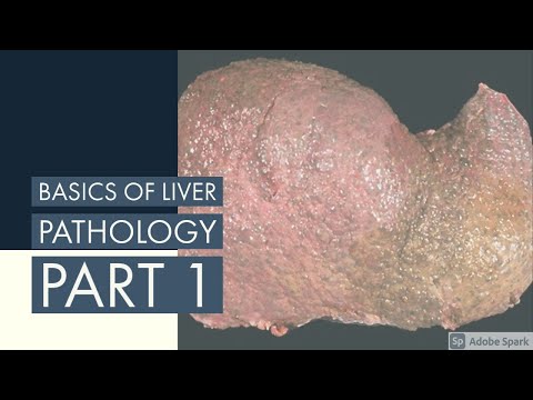  BASICS OF LIVER PATHOLOGY II PART 1 II SYSTEMIC PATHOLOGY II LIVER II ROBBINS 10TH EDITION