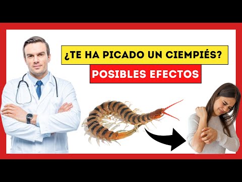 😱What Happens if You Get Stung by a Centipede? [Serious Consequences of Stings!!]