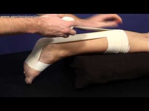 A Taping Technique for use in Achilles Tendon Injuries
