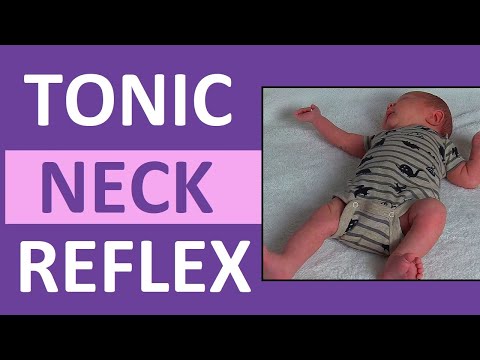 Tonic Neck Reflex in Infant Newborn | Pediatric Nursing Newborn Assessment