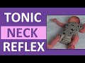 Tonic Neck Reflex in Infant Newborn | Pediatric Nursing Newborn Assessment