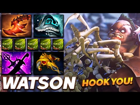 Watson Pudge Hook Master Reaction - Dota 2 Pro Gameplay [Watch & Learn]