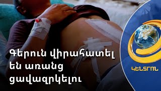 Ադրբեջանում հայ գերուն վիրահատել են առանց ցավազրկելու. ՄԻՊ-ը հավաքագրել է Բաքվի վայրագությունները