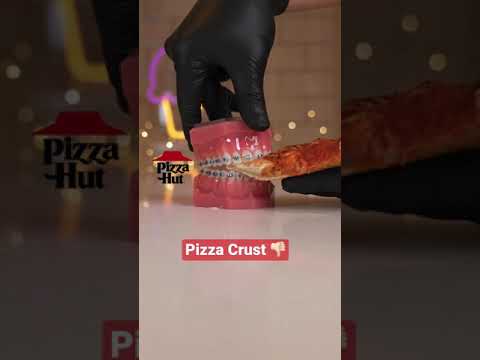 Pizza Hut Food Choices | ASMR | Braces Food Choices w/ TheBracesDoc