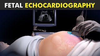Fetal Echocardiography - Exploring the Heart of the Unborn