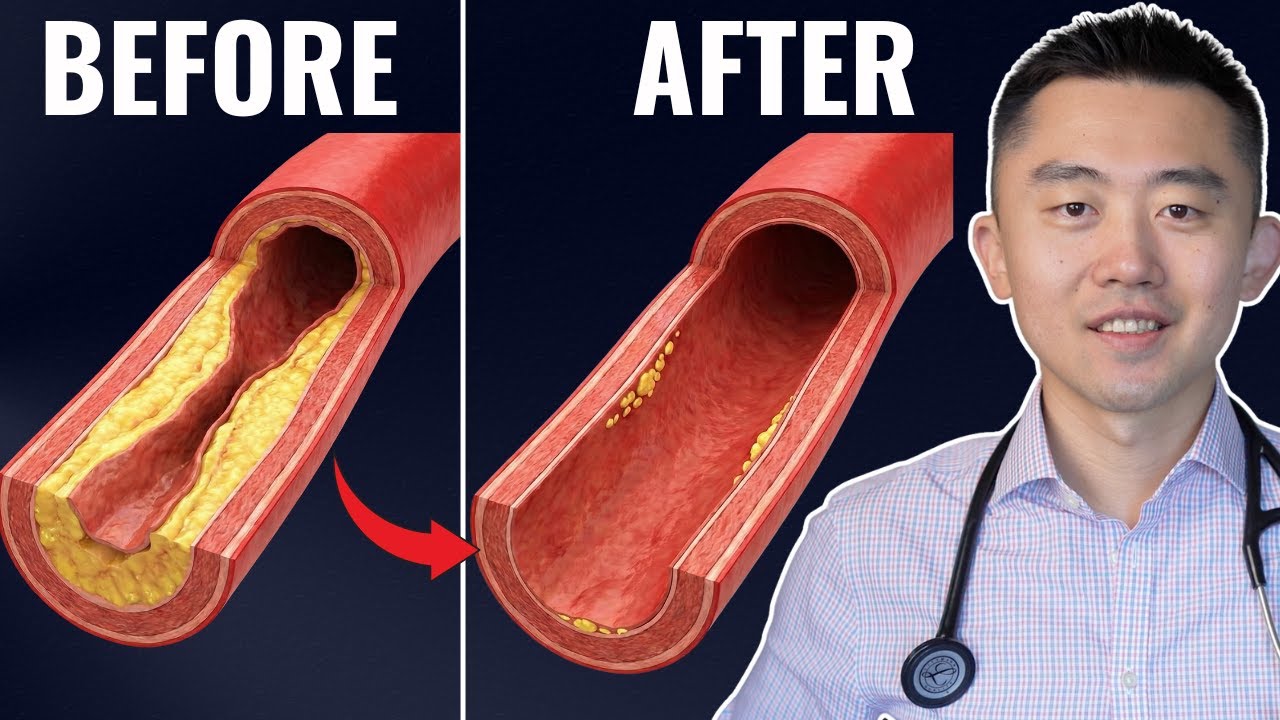 #1 Best Meal to UNCLOG Your Arteries (Backed by Science)