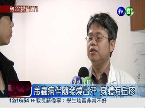 清明掃墓防恙蟲 長袖衣物護身!