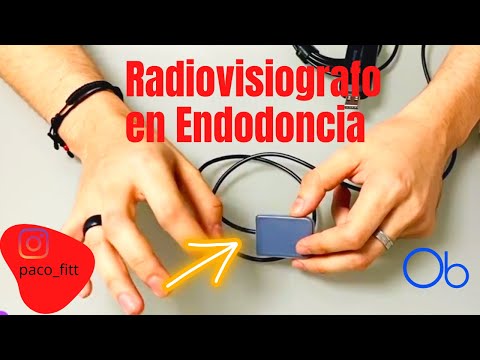 Radiovisiografo en Endodoncia