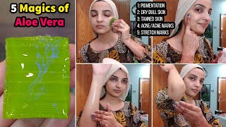 Only Aloe Vera Gel Can Cure these 5 Problems Like Pigmentation & Dark Lines