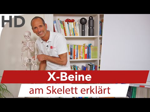 Als der Pilze der Nägel auf den Beinen zu heilen Gribok auf den Beinen bei den Kindern die Behandlung das Forum