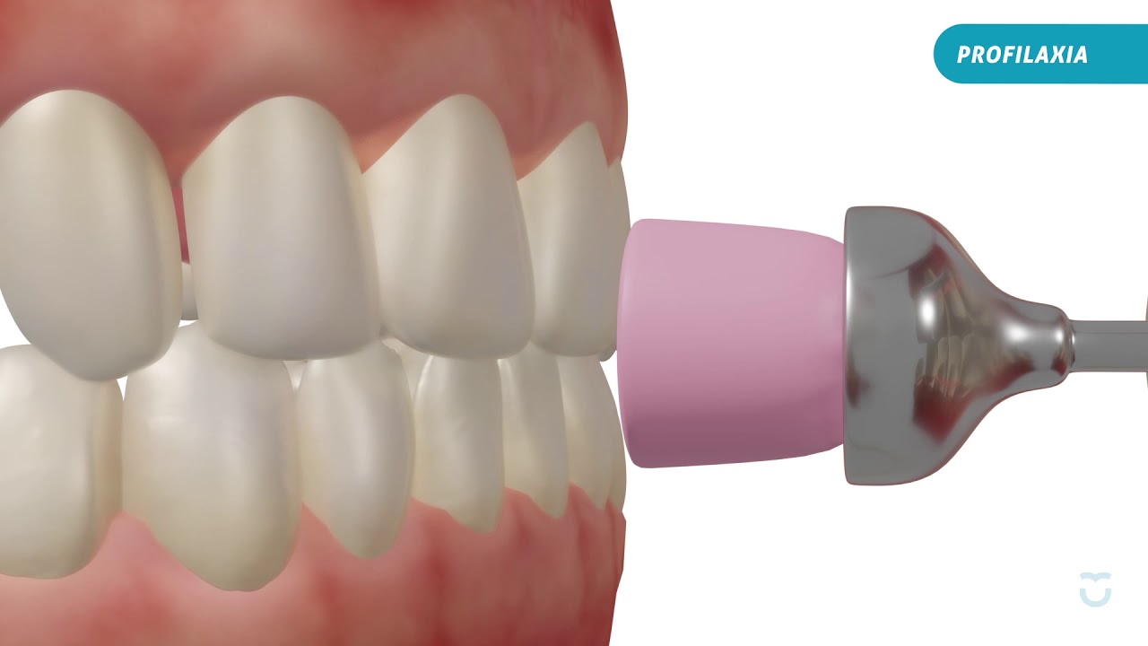 Watch Now Tratamentos | Profilaxia Tratamentos | Profilaxia