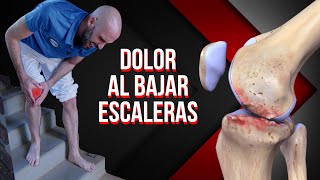 ¿Dolor de rodilla al bajar escaleras Ejercicios y masaje para solucionarlo